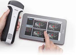 asus smartphone ultrasound probe for sale