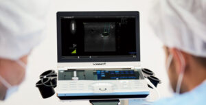 VINNO 6 Laptop Ultrasound Scanner