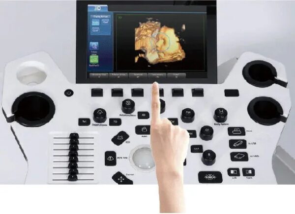 Vinno X2 Affordable 4D Ultrasound Scanner for Sale - Image 5