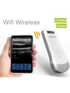 Wireless Ultrasound Probe