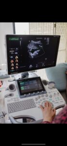 GE Voluson S10 Expert 3D/4D  Ultrasound System (Direct Sale)